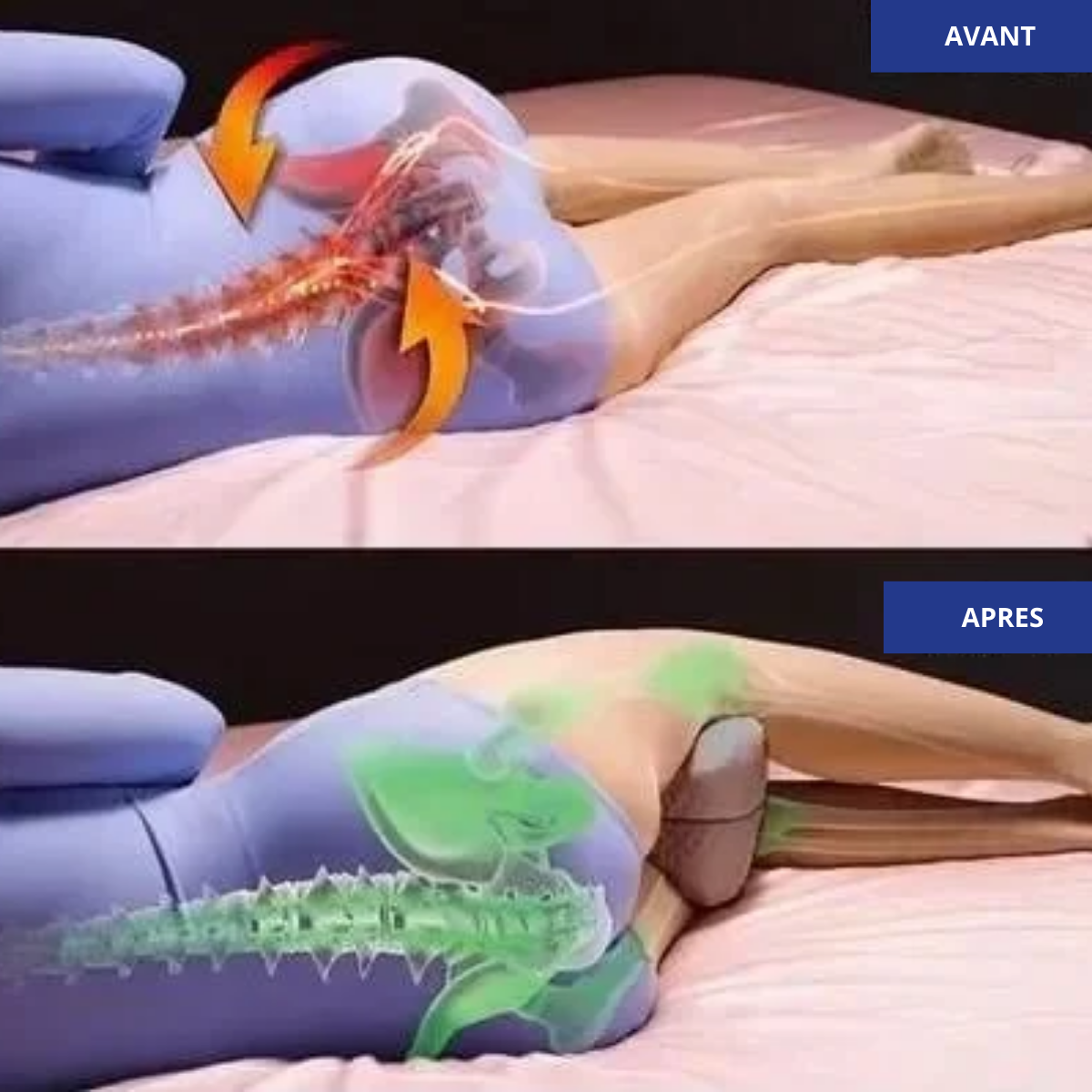 Coussin entre les jambes